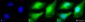 Akt2 (PKB beta) Antibody
